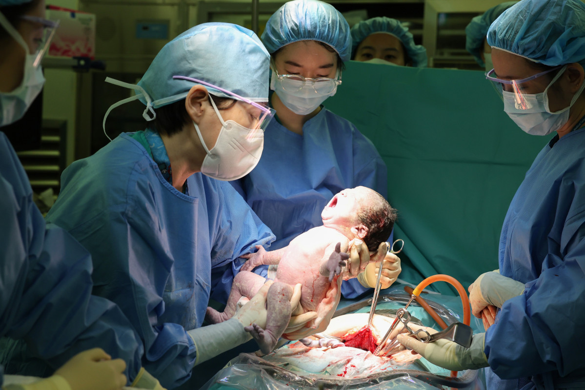 ▲원혜성 서울아산병원 산부인과 교수(왼쪽 두 번째)가 지난달 300번째 분만 수술을 시행하고 있다. (사진제공=서울아산병원)