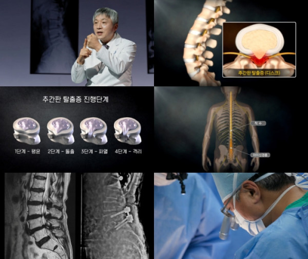 ▲'명의' (사진제공=EBS1 )