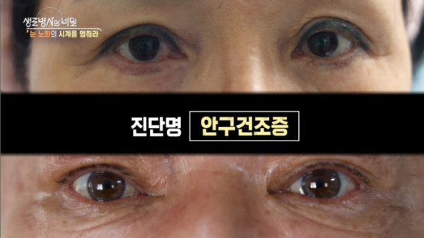 ▲'생로병사의비밀'(사진제공=KBS 1TV)