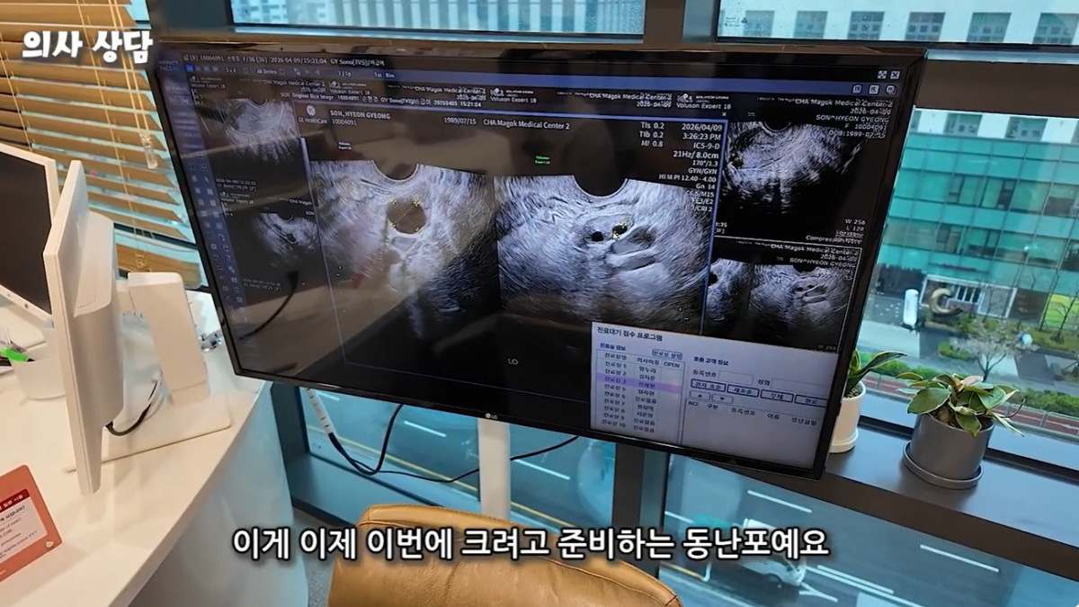 ▲서울 마곡 차병원에서 냉동난자 관련 진료를 받은 기자가 한세열 원장에게 이번 주기에 "키워볼 수 있는 난포가 7개 정도”라고 설명 받고 있다. (이은지 PD)