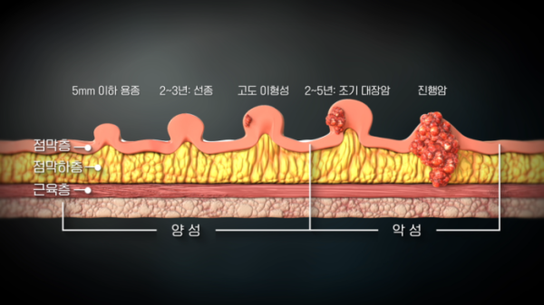 ▲'명의' (사진출처=EBS1 )