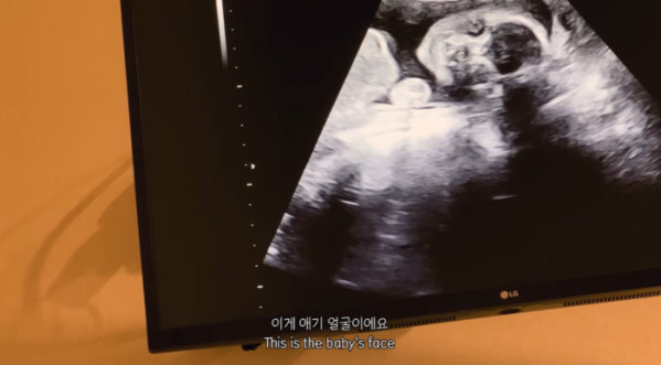 ▲박주호 아내 안나 박이 넷째 임신을 밝혔다.(사진=유튜브 채널 '집에서 안나와')