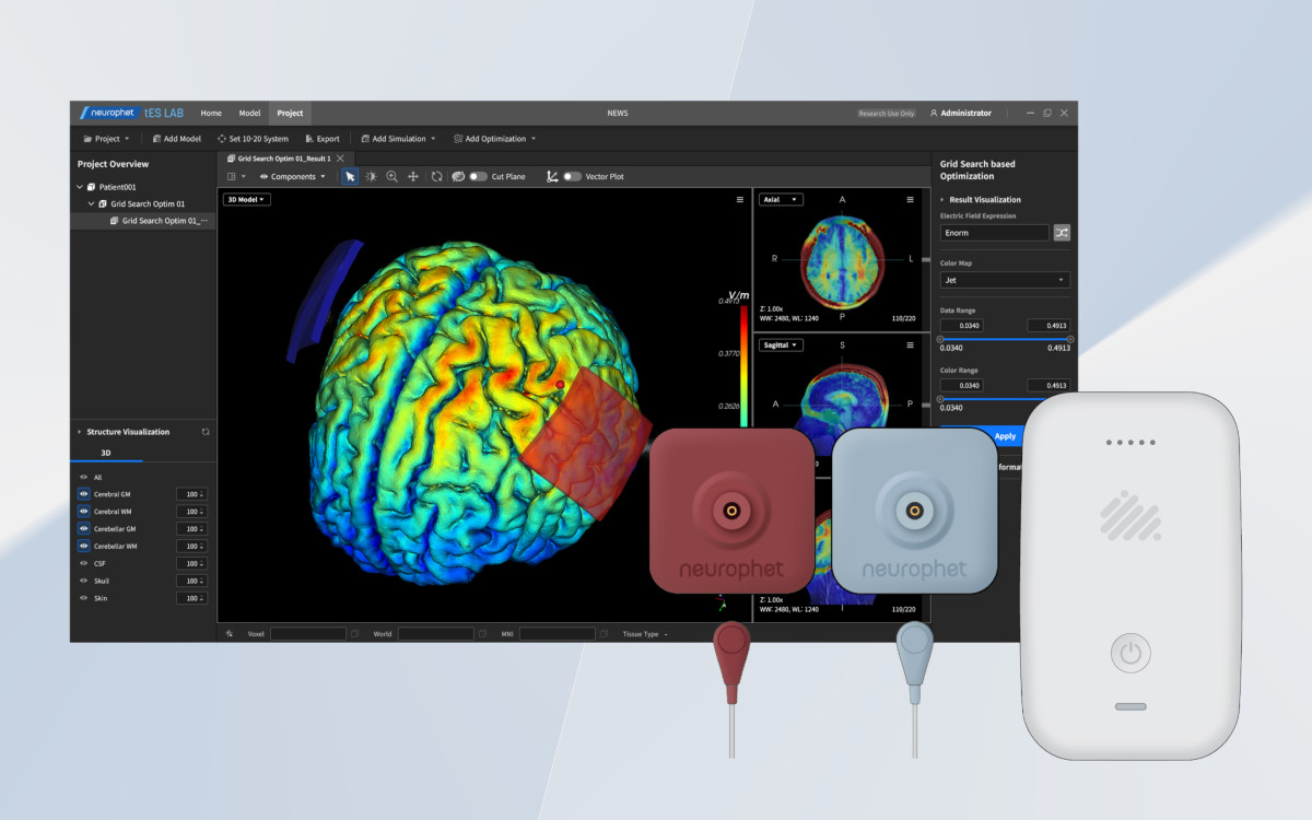 ▲개인 맞춤형 tDCS 솔루션. (사진제공=뉴로핏)