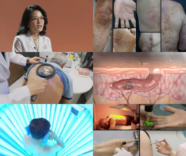 ▲'명의' (사진출처=EBS1 )