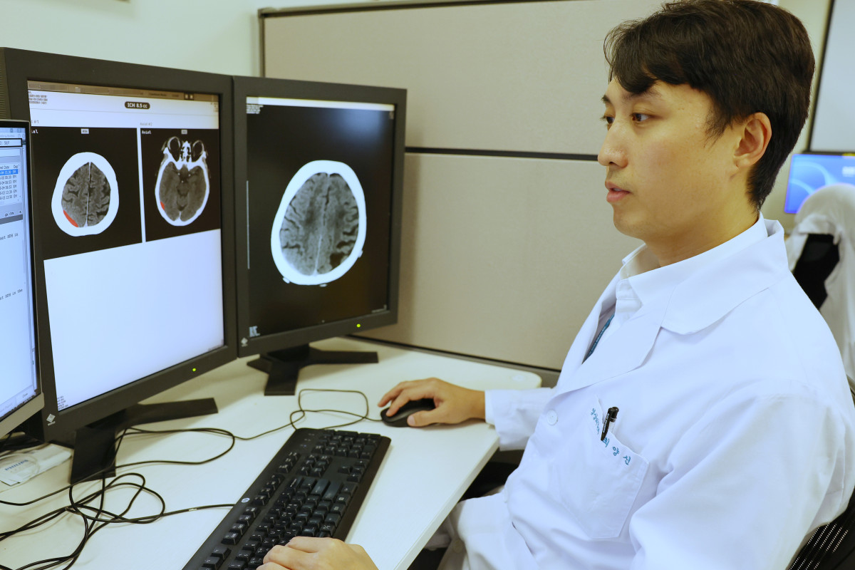 ▲최양신 서울아산병원 영상의학과 교수가 뇌 자기공명영상(MRI) 판독에 AI를 활용하고 있다. (사진제공=서울아산병원)